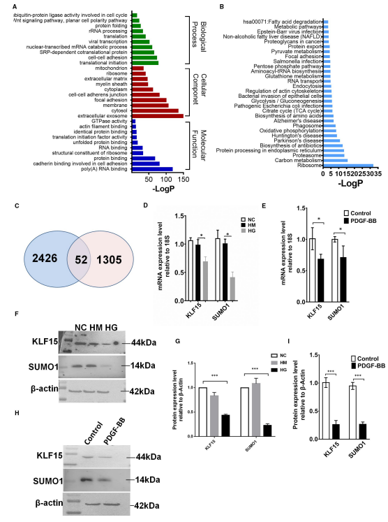 FIGURE 2 Bioinformatics analysis of KLF15-binding genes. A, DAVID analysis and IPA were performed to acquire the GO domains of the 1,357 SILAC-LC/MS-screened proteins. B, Top 30 signalling pathways identified by IPA of the SILAC-LC/MS data. C, Fifty-two genes identified by bioinformatics analysis of ChIP-Seq data and SILAC-LC/MS data. D, KLF15 and SUMO1 mRNA expression in HG-treated HRMCs. E, KLF15 and SUMO1 mRNA expression in PDGF-BB-treated HRMCs. F-G, KLF15 and SUMO1 protein expression in HG-treated HRMCs. H-I, KLF15 and SUMO1 protein expression in PDGF-BB-treated HRMCs. *P < .05, ***P < .01, n = 3 FIGURE 2 Bioinformatics analysis of KLF15-binding genes. A, DAVID analysis and IPA were performed to acquire the GO domains of the 1,357 SILAC-LC/MS-screened proteins. B, Top 30 signalling pathways identified by IPA of the SILAC-LC/MS data. C, Fifty-two genes identified by bioinformatics analysis of ChIP-Seq data and SILAC-LC/MS data. D, KLF15 and SUMO1 mRNA expression in HG-treated HRMCs. E, KLF15 and SUMO1 mRNA expression in PDGF-BB-treated HRMCs. F-G, KLF15 and SUMO1 protein expression in HG-treated HRMCs. H-I, KLF15 and SUMO1 protein expression in PDGF-BB-treated HRMCs. *P < .05, ***P < .01, n = 3